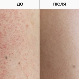 Отшелушивающий гель для душа с AHA- и BHA-кислотами Resurfacing Targeted Body Cleanser GROWN ALCHEMIST Объем 300 мл — фото 4