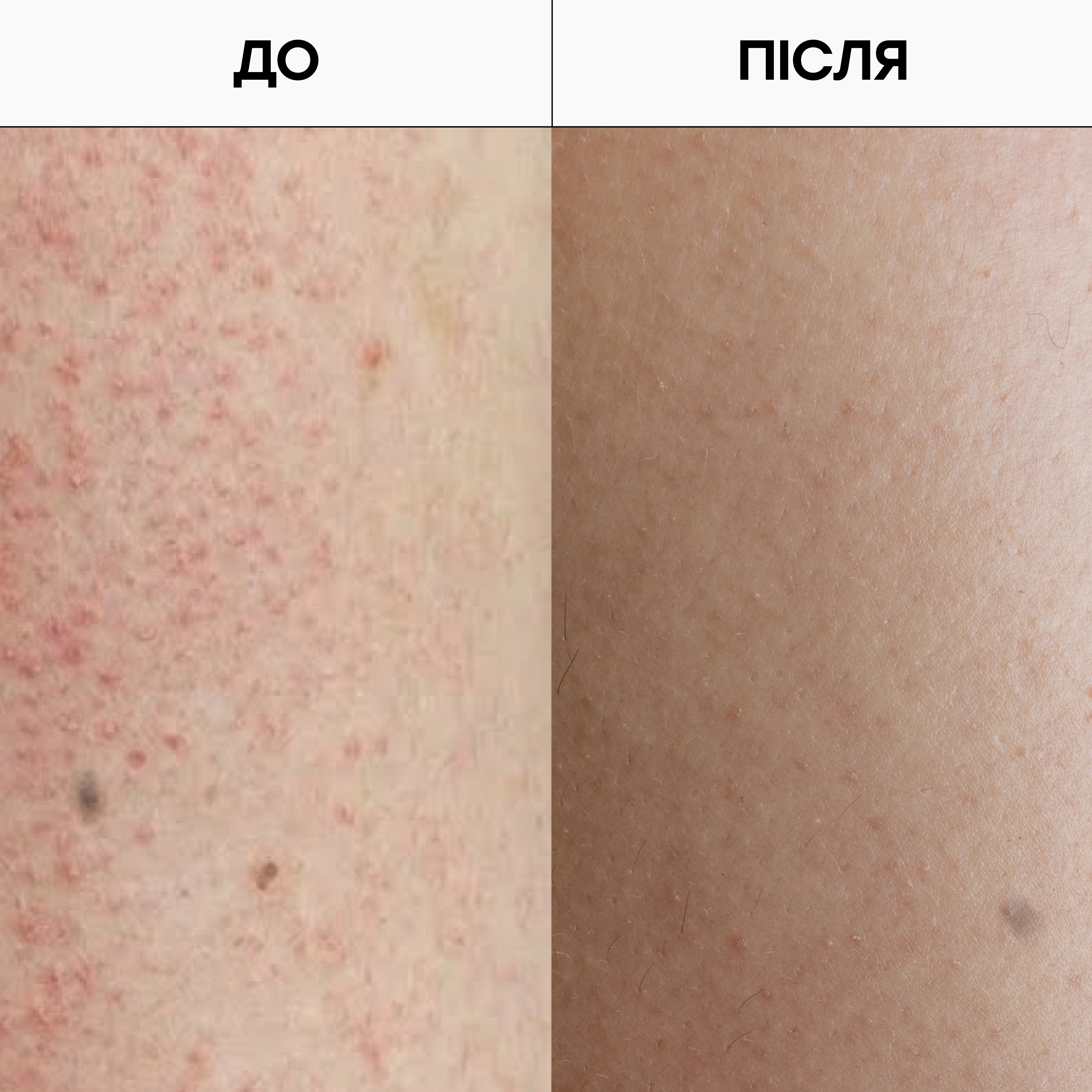Отшелушивающий гель для душа с AHA- и BHA-кислотами Resurfacing Targeted Body Cleanser GROWN ALCHEMIST Объем 300 мл — фото 4