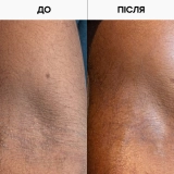 Відлущувальний лосьйон для тіла з AHA- та BHA-кислотами Resurfacing Targeted Body Lotion GROWN ALCHEMIST Обʼєм 300 мл — фото 6