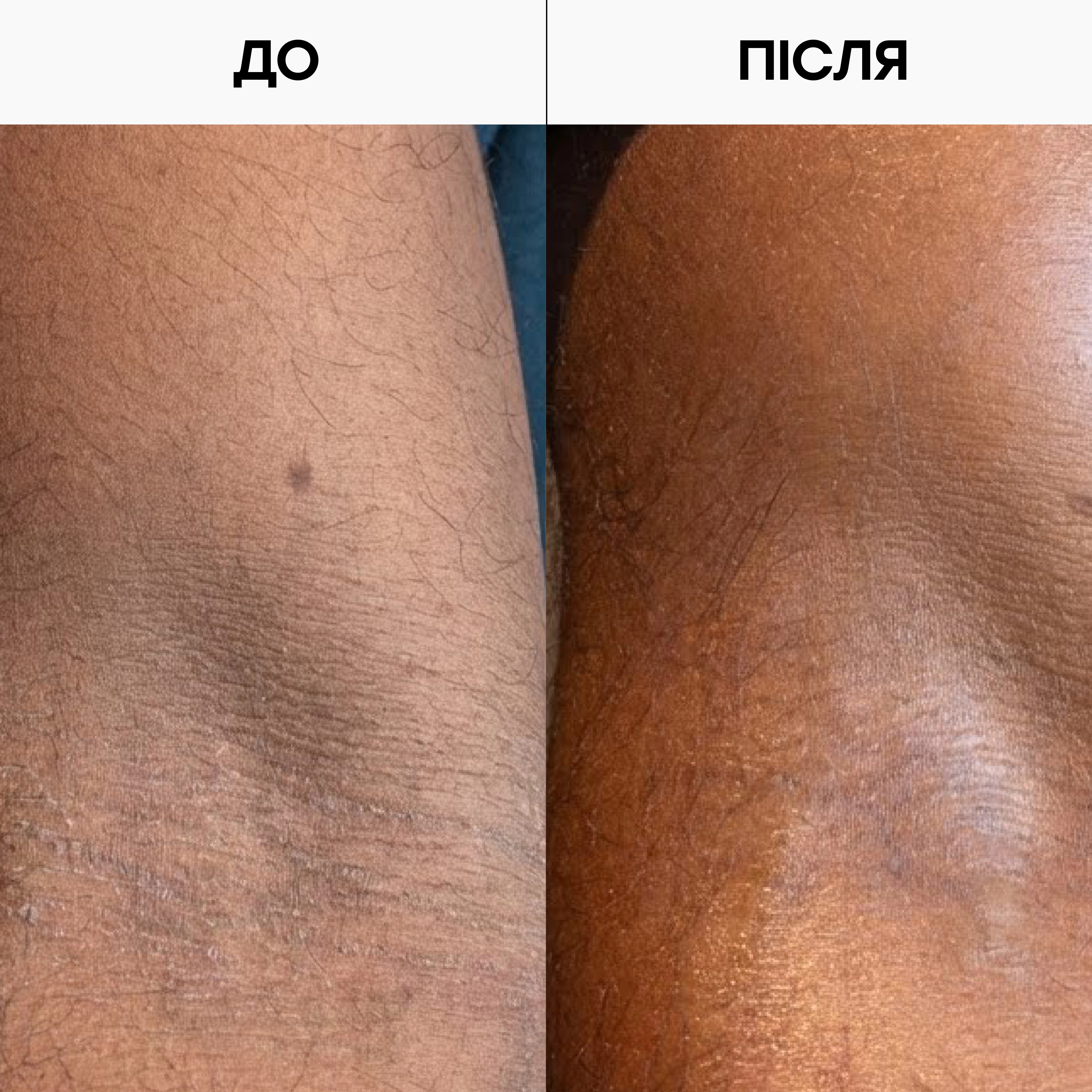 Відлущувальний лосьйон для тіла з AHA- та BHA-кислотами Resurfacing Targeted Body Lotion GROWN ALCHEMIST Обʼєм 300 мл — фото 6