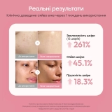 Відновлювальна бульбашкова сироватка з полінуклеотидами та колагеном PDRN Pink Collagen Bubble Serum MEDICUBE Обʼєм 95 мл — фото 5
