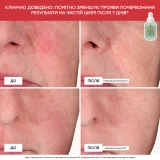 Успокаивающая сыворотка против покраснений Centella Red Serum ERBORIAN Объем 30 мл — фото 4