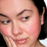 Локальний засіб із 5% сіркою для заспокоєння почервоніння The Calming Solution – 5% Sulfur Treatment MANTLE Обʼєм 30 мл — фото 3