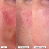 Локальний засіб із 5% сіркою для заспокоєння почервоніння The Calming Solution – 5% Sulfur Treatment MANTLE Обʼєм 30 мл — фото 4