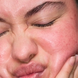 Локальний засіб із 5% сіркою для заспокоєння почервоніння The Calming Solution – 5% Sulfur Treatment MANTLE Обʼєм 30 мл — фото 5