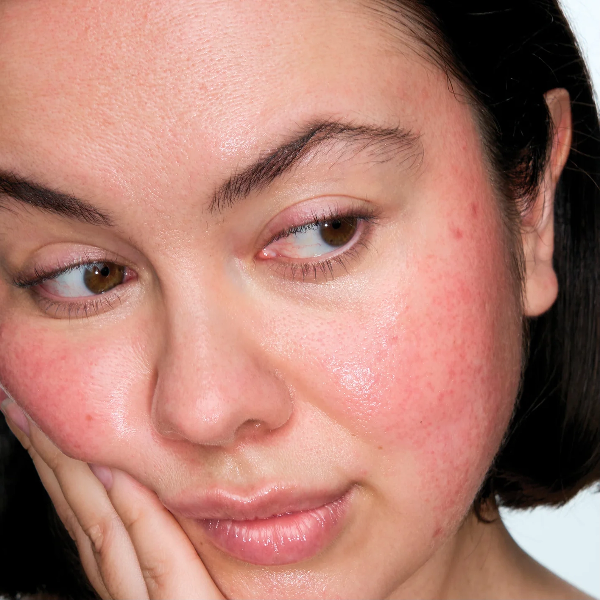 Локальний засіб із 5% сіркою для заспокоєння почервоніння The Calming Solution – 5% Sulfur Treatment MANTLE Обʼєм 30 мл — фото 3