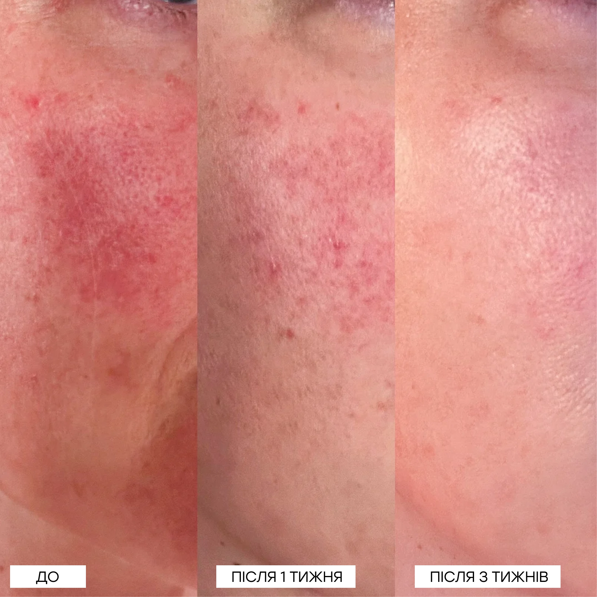 Локальний засіб із 5% сіркою для заспокоєння почервоніння The Calming Solution – 5% Sulfur Treatment MANTLE Обʼєм 30 мл — фото 4