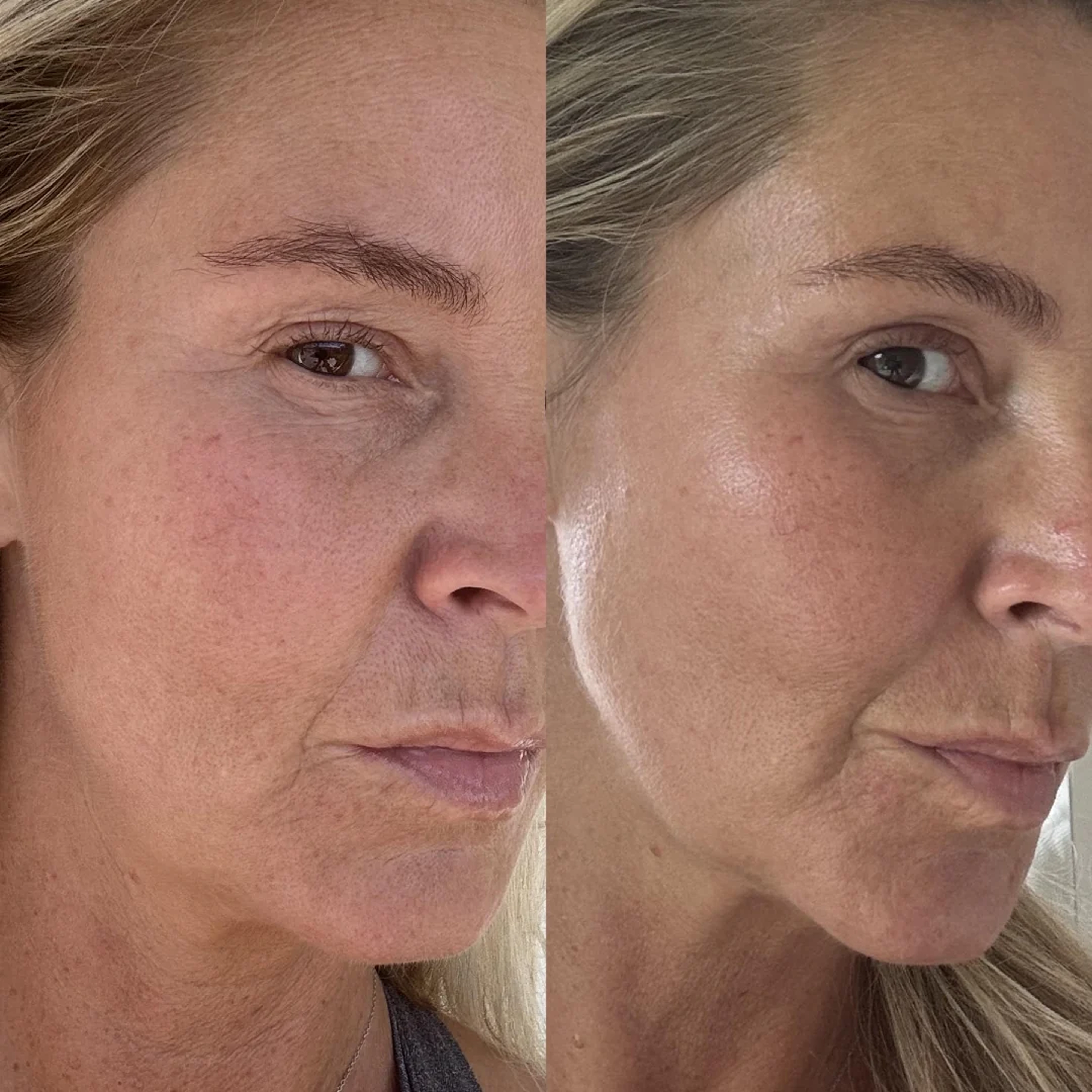 Інтенсивно зволожувальна сироватка з муцином медузи The Hydra Serum – Skin-Replenishing Hydration Serum MANTLE Обʼєм 10 мл — фото 4