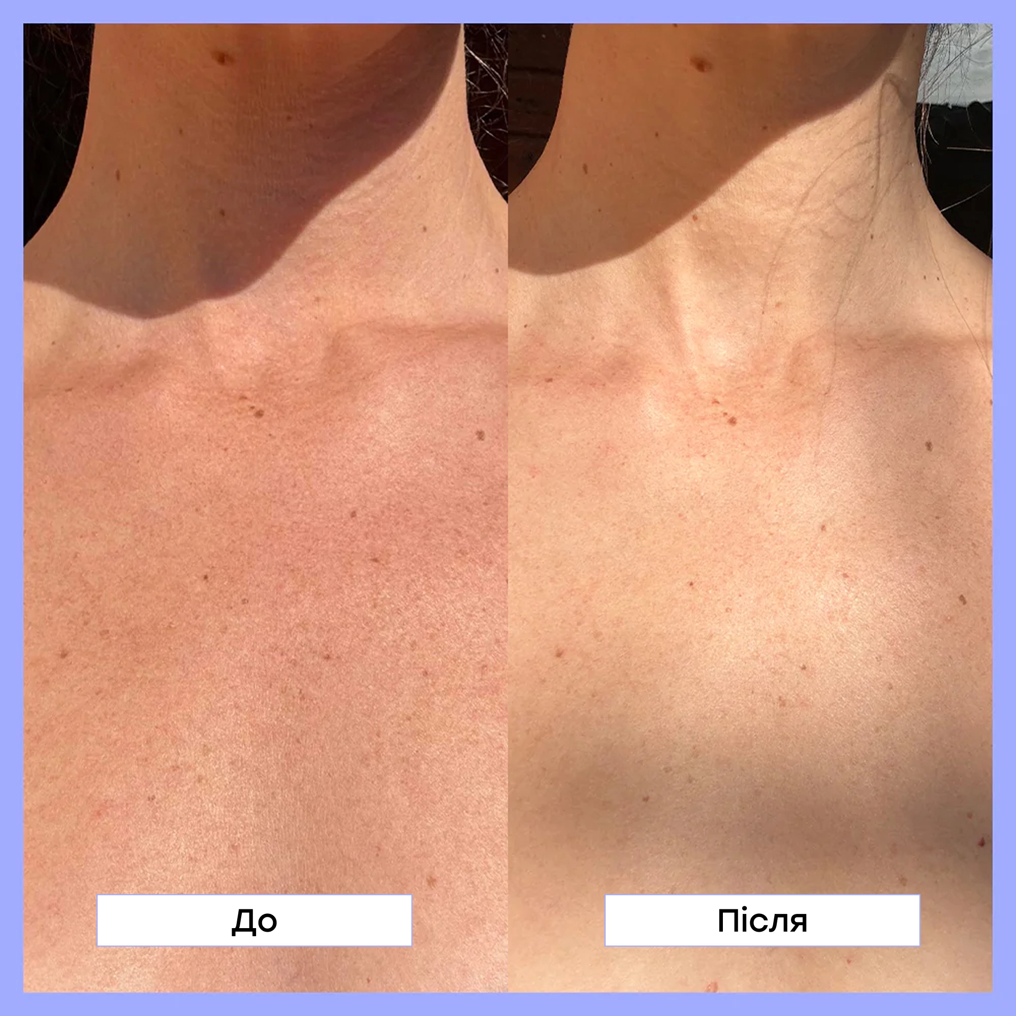 Лосьйон для тіла з ретинолом Retinol Body Lotion FRANK BODY Обʼєм 140 мл — фото 4