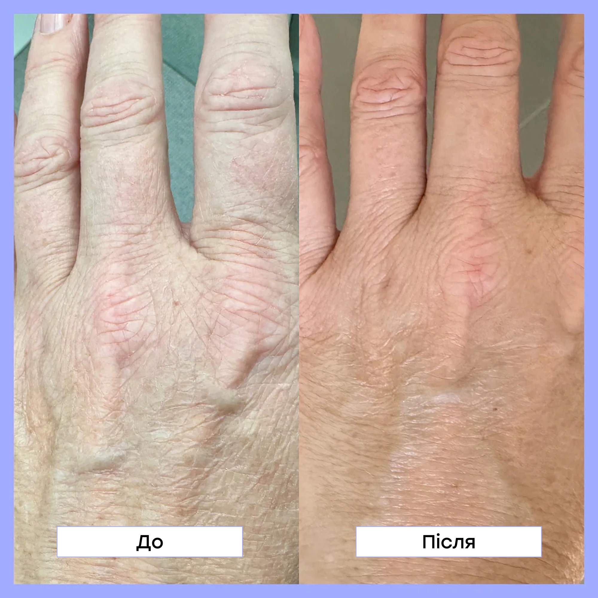 Лосьйон для тіла з ретинолом Retinol Body Lotion FRANK BODY Обʼєм 140 мл — фото 5