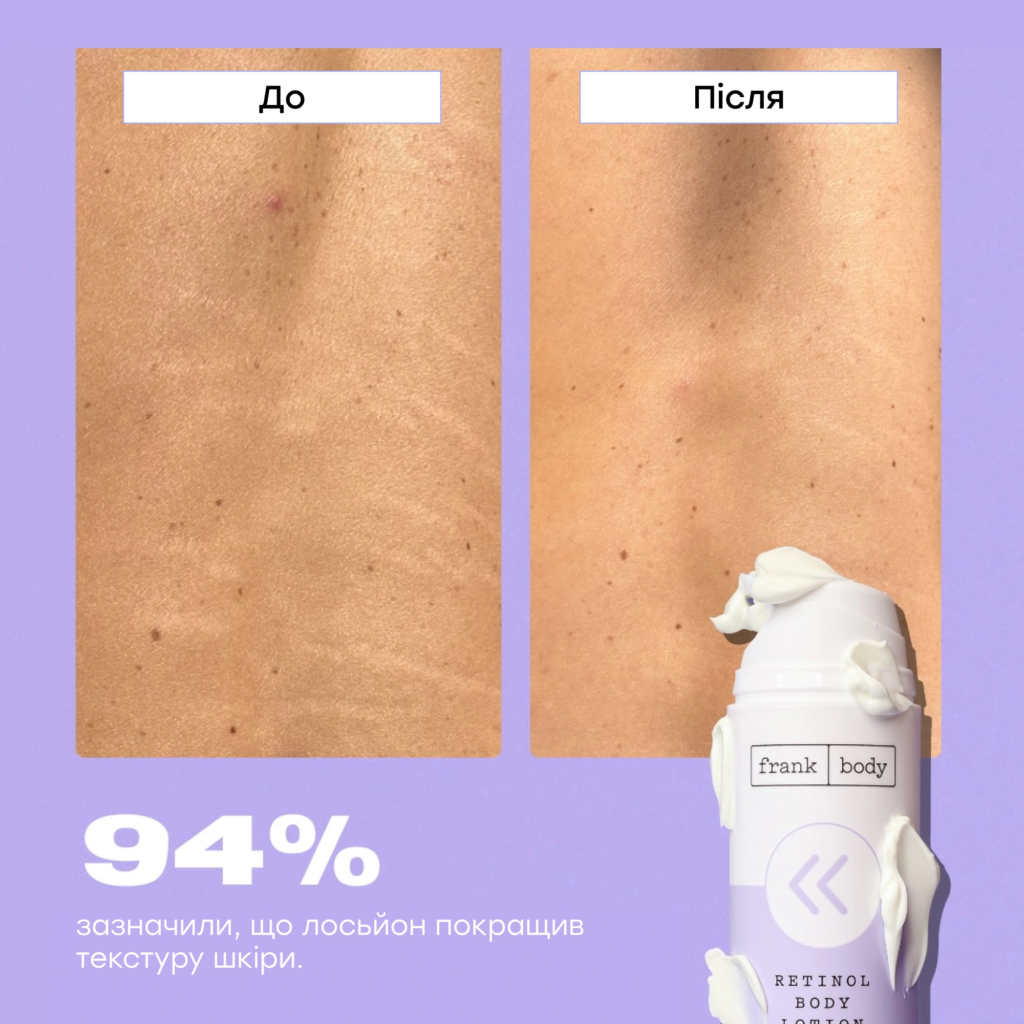 Лосьйон для тіла з ретинолом Retinol Body Lotion FRANK BODY Обʼєм 140 мл — фото 6