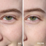 Гідрогелеві патчі для шкіри навколо очей Hydrogel Under Eye Patches MARIO BADESCU — фото 5