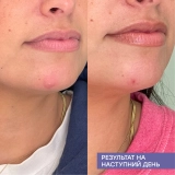 Очищувальний міст для обличчя та тіла з гіпохлоритною кислотою Repairing Facial Spray MARIO BADESCU Обʼєм 118 мл — фото 8