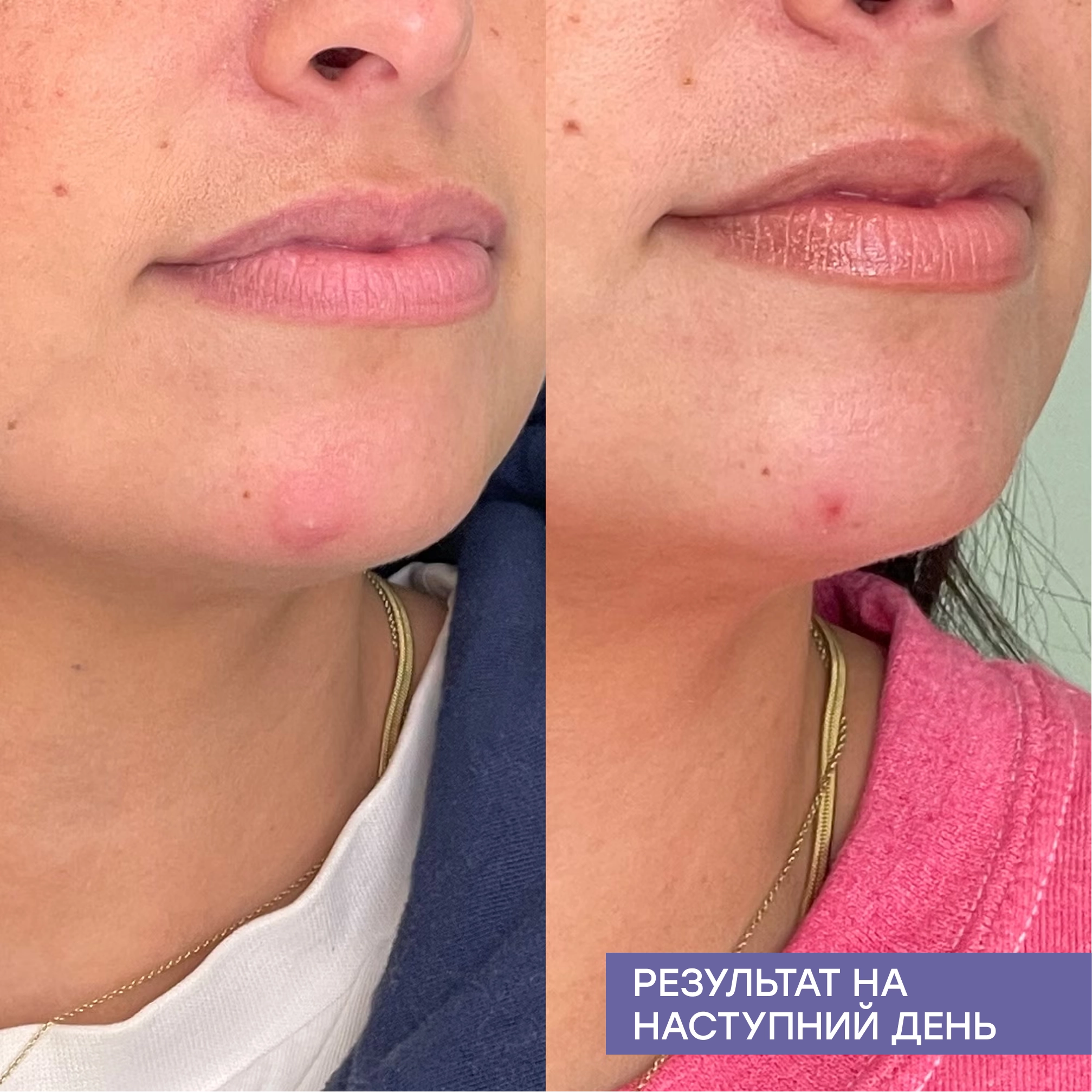 Очищувальний міст для обличчя та тіла з гіпохлоритною кислотою Repairing Facial Spray MARIO BADESCU Обʼєм 118 мл — фото 8