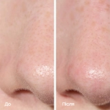 Двосторонній патч для глибокого очищення пор 2-в-1 2-in-1 Deep Cleansing Pore Strip MARIO BADESCU — фото 5