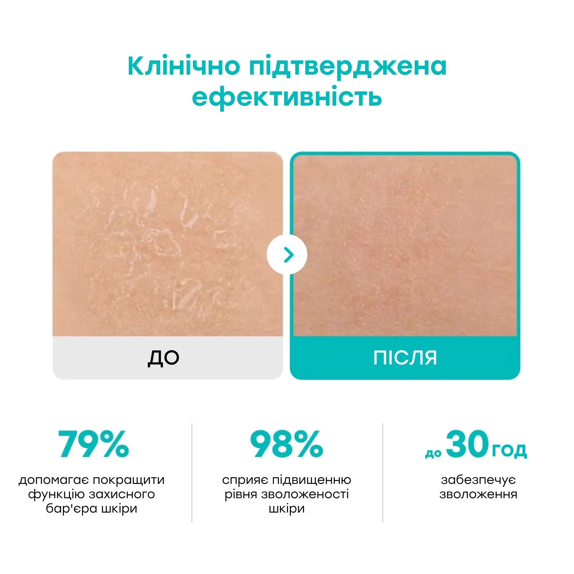 Зволожувальний крем для відновлення захисного бар'єра Moisture Cream REJURAN Вага 60 г — фото 5
