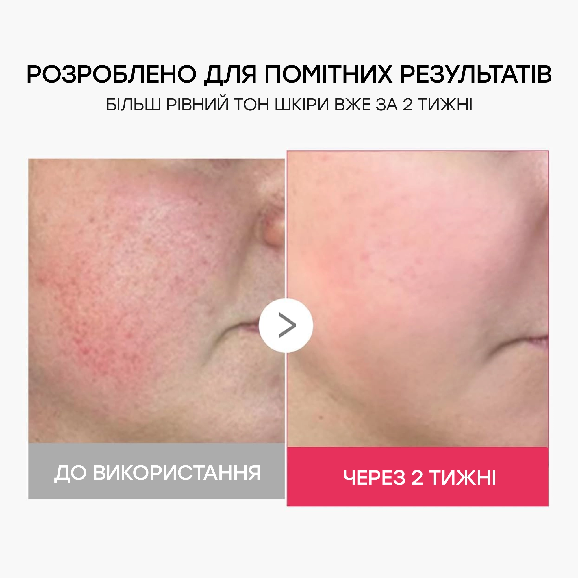 Міні-пристрій для домашнього догляду за шкірою Age-R Booster Pro Mini Plus MEDICUBE Відтінок Beige — фото 6