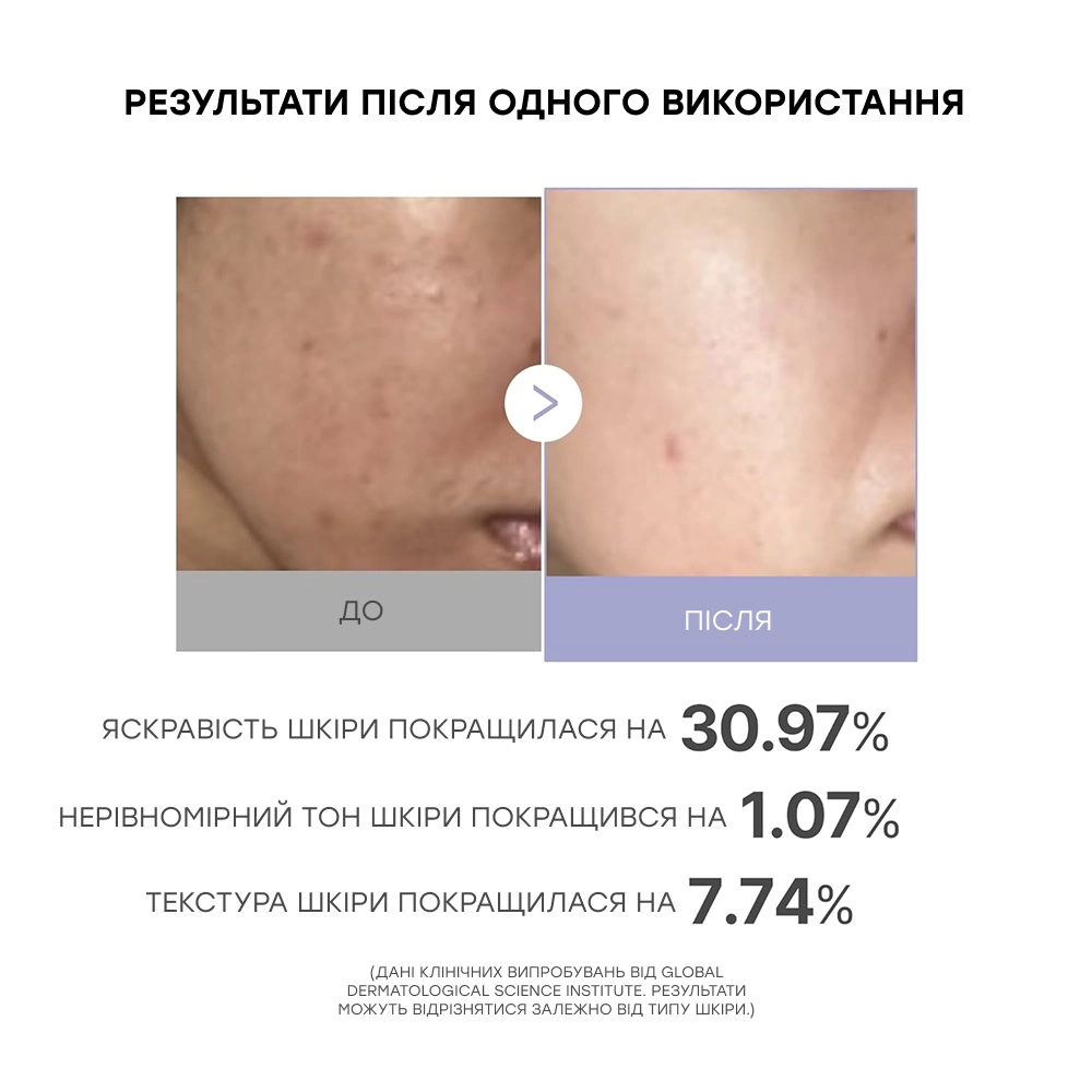 Міні-пристрій для домашнього догляду за шкірою Age-r Booster Pro Mini MEDICUBE Відтінок White — фото 3
