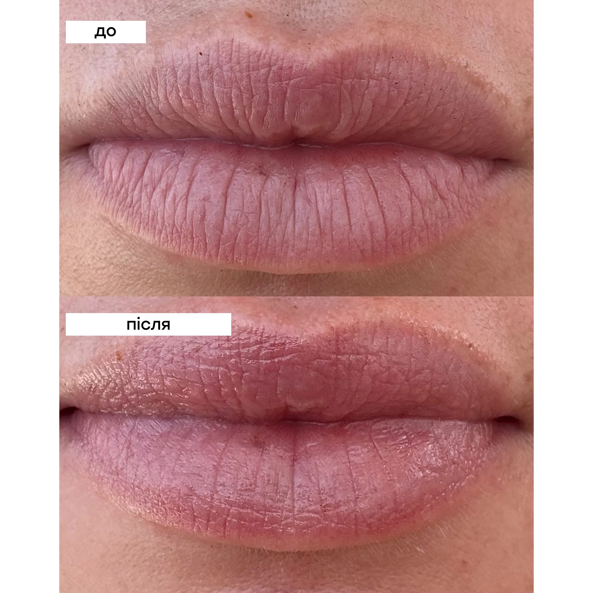 Відновлювальний бальзам для губ із церамідами Barrier Protect Lip Treatment FRANK BODY Вага 4 г — фото 4