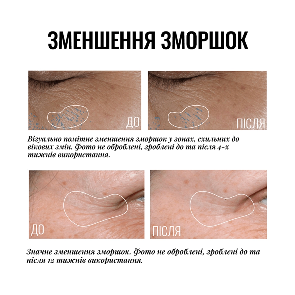 Крем-ліфтинг для повік з освітлювальним ефектом Truly-Transforming Brightening Eye Cream INSTYTUTUM Обʼєм 15 мл — фото 4