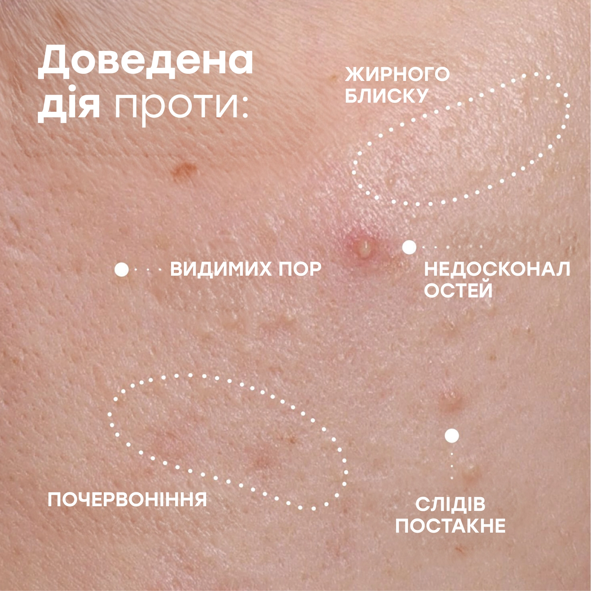 Коригуюча сироватка проти висипань Corrective Serum Blemish Prone Skin SISLEY PARIS Обʼєм 30 мл — фото 5