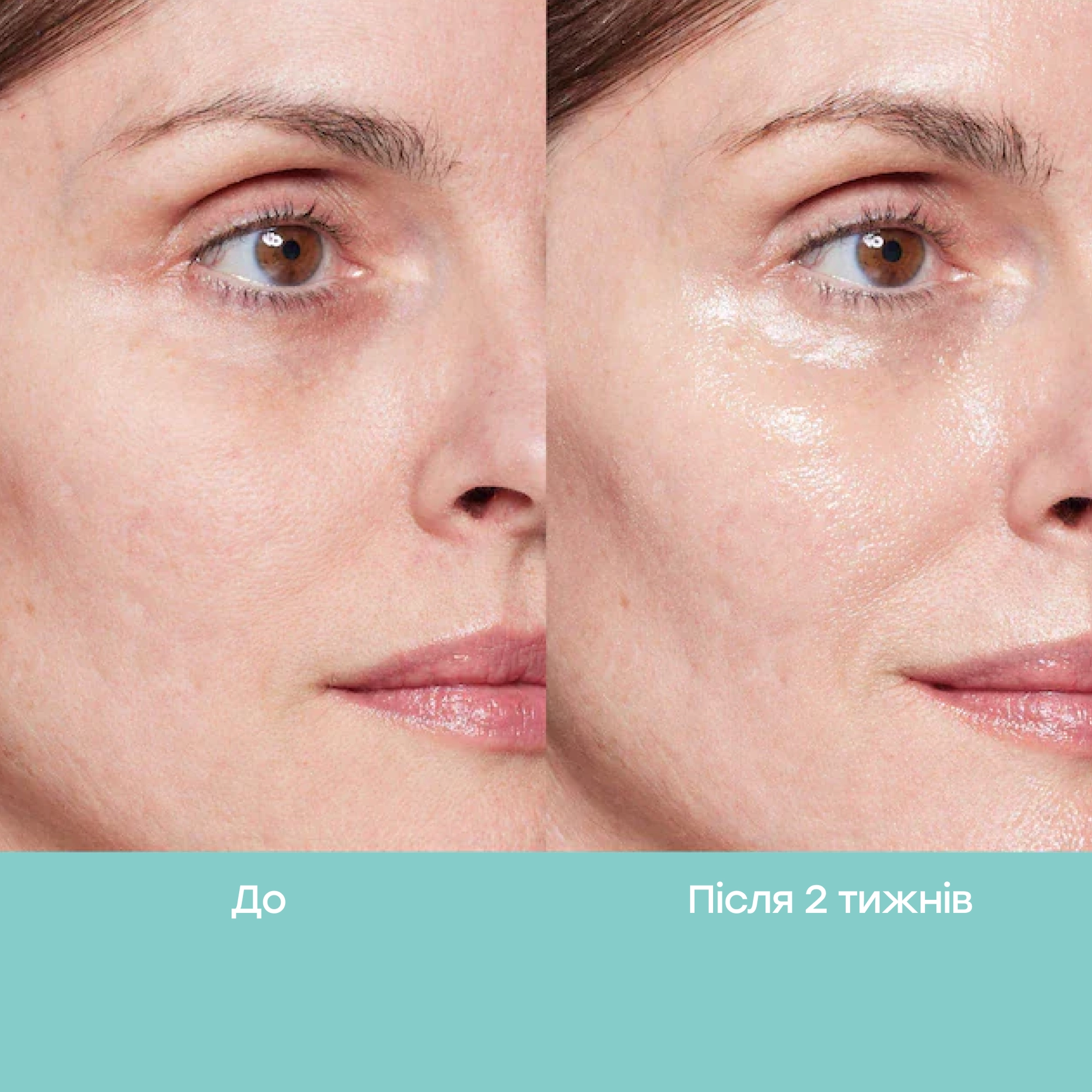Набір для інтенсивного відновлення та сяйва шкіри Glow-Up Skincare Set REJURAN — фото 4