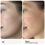 Многофункциональный кушон с полинуклеотидами (сменный блок) Skinglow Cushion SPF 50+ Refill REJURAN Вес 15 г — фото 4