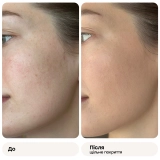 Многофункциональный кушон с полинуклеотидами (сменный блок) Skinglow Cushion SPF 50+ Refill REJURAN Вес 15 г — фото 5