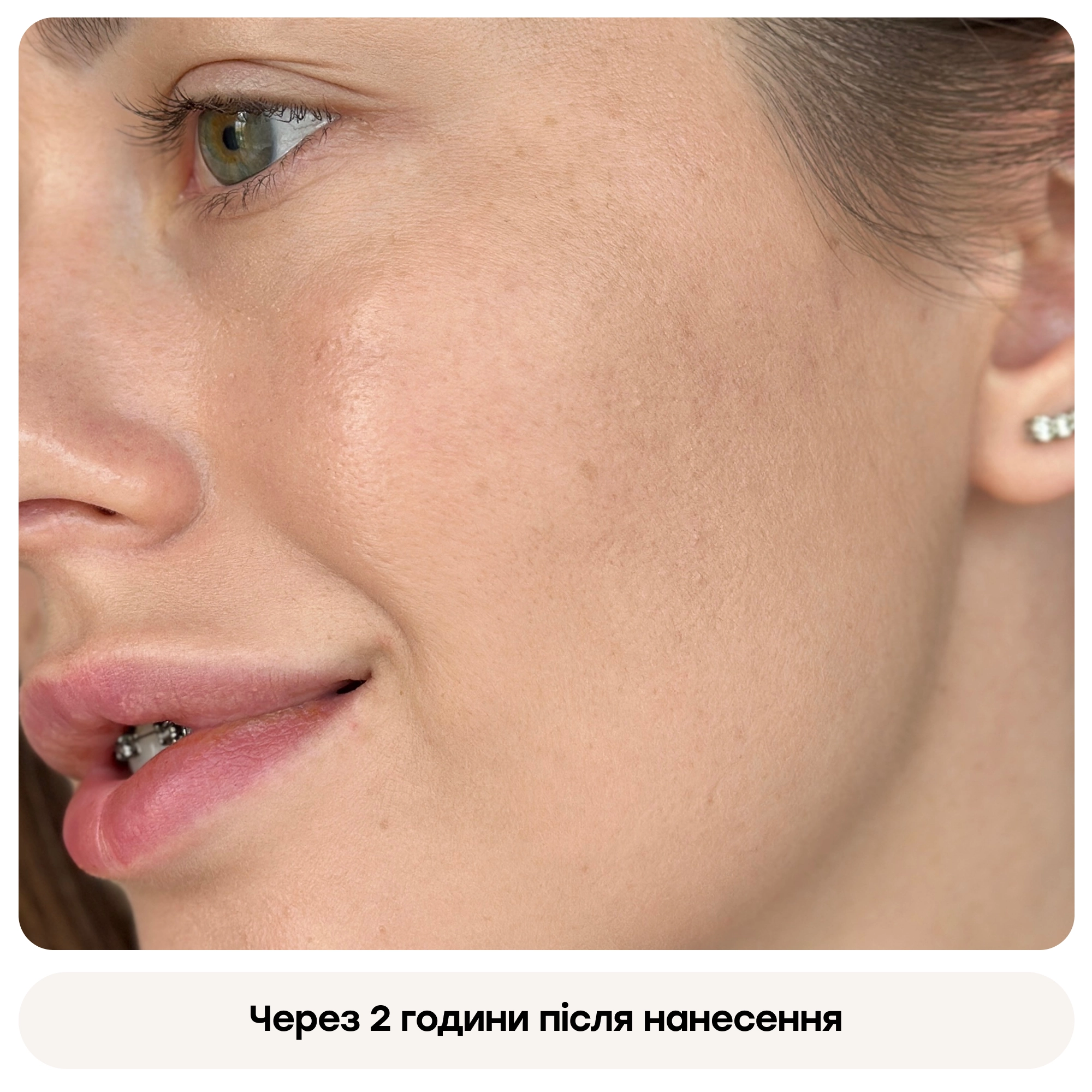 Многофункциональный кушон с полинуклеотидами (сменный блок) Skinglow Cushion SPF 50+ Refill REJURAN Вес 15 г — фото 7