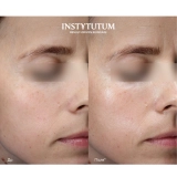 Зволожувальний крем з ефектом сяяння + змінний блок (рефіл) C-Illuminating 3D Moisturizer Refill Duo INSTYTUTUM — фото 4