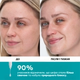 Сироватка для пружності та розгладження шкіри Collagen Skinjection Plumping & Firming Serum PETER THOMAS ROTH Обʼєм 30 мл — фото 3