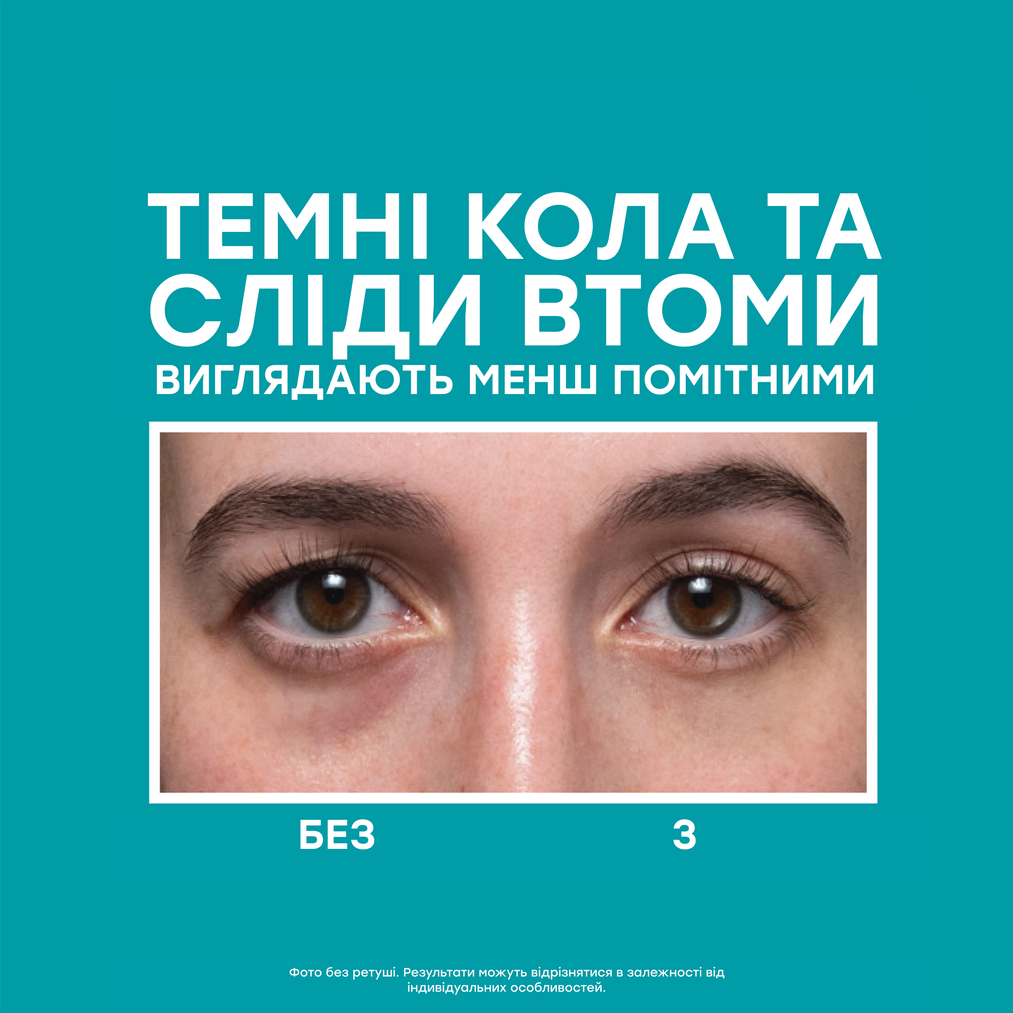 Полноразмерный набор для комплексного антивозрастного ухода Full-Size Peptide Skinjection™ 2-Piece Kit Face & Eye Kit PETER THOMAS ROTH — фото 4