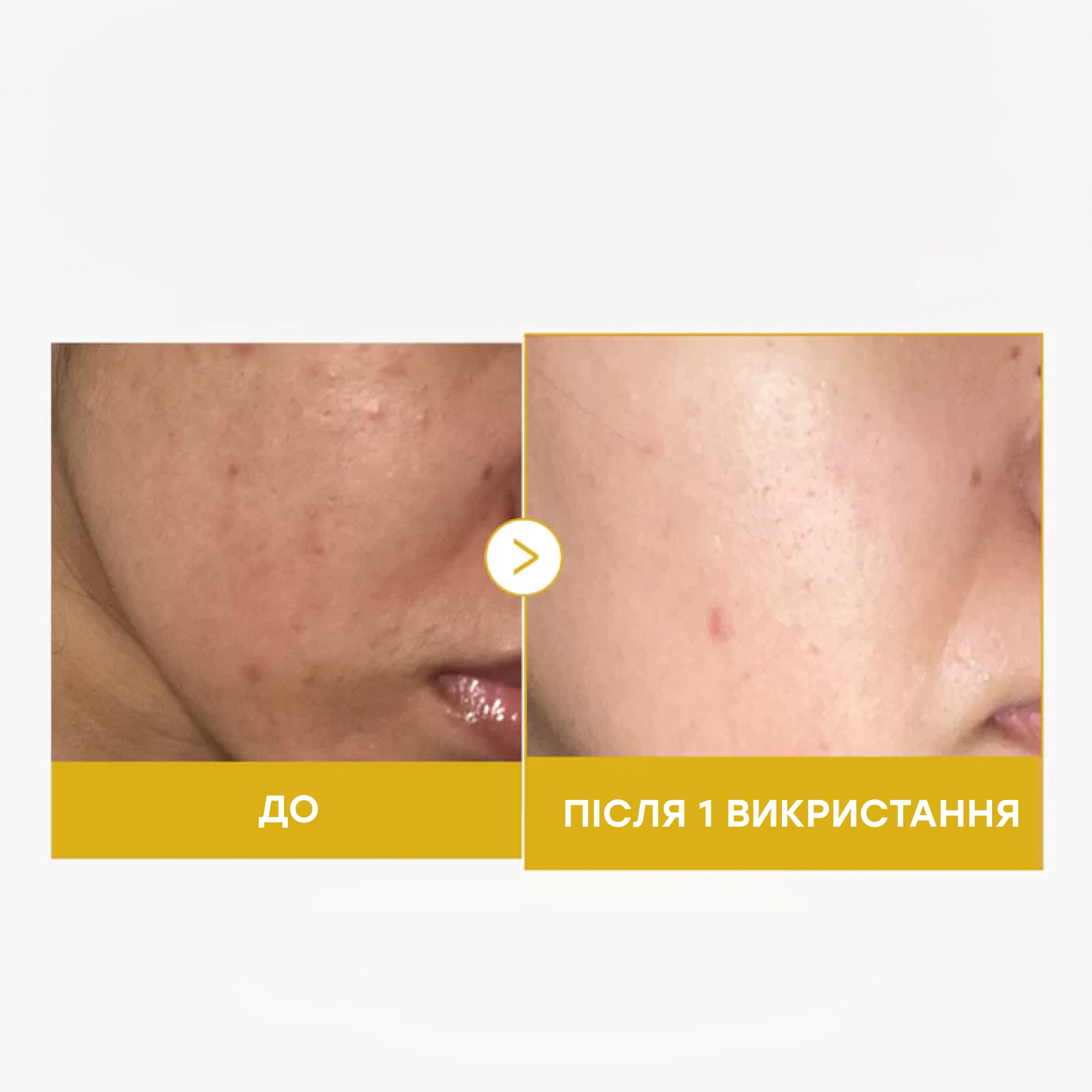 Нічна маска з койєвою кислотою та куркумою Kojic Acid Turmeric Night Wrapping Mask MEDICUBE Обʼєм 75 мл — фото 4