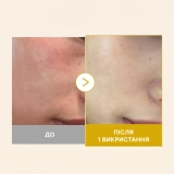 Освітлювальна гель-сироватка з кодзієвою кислотою та куркумою Kojic Acid Turmeric Vita Jelly Mist Serum MEDICUBE Обʼєм 100 мл — фото 5