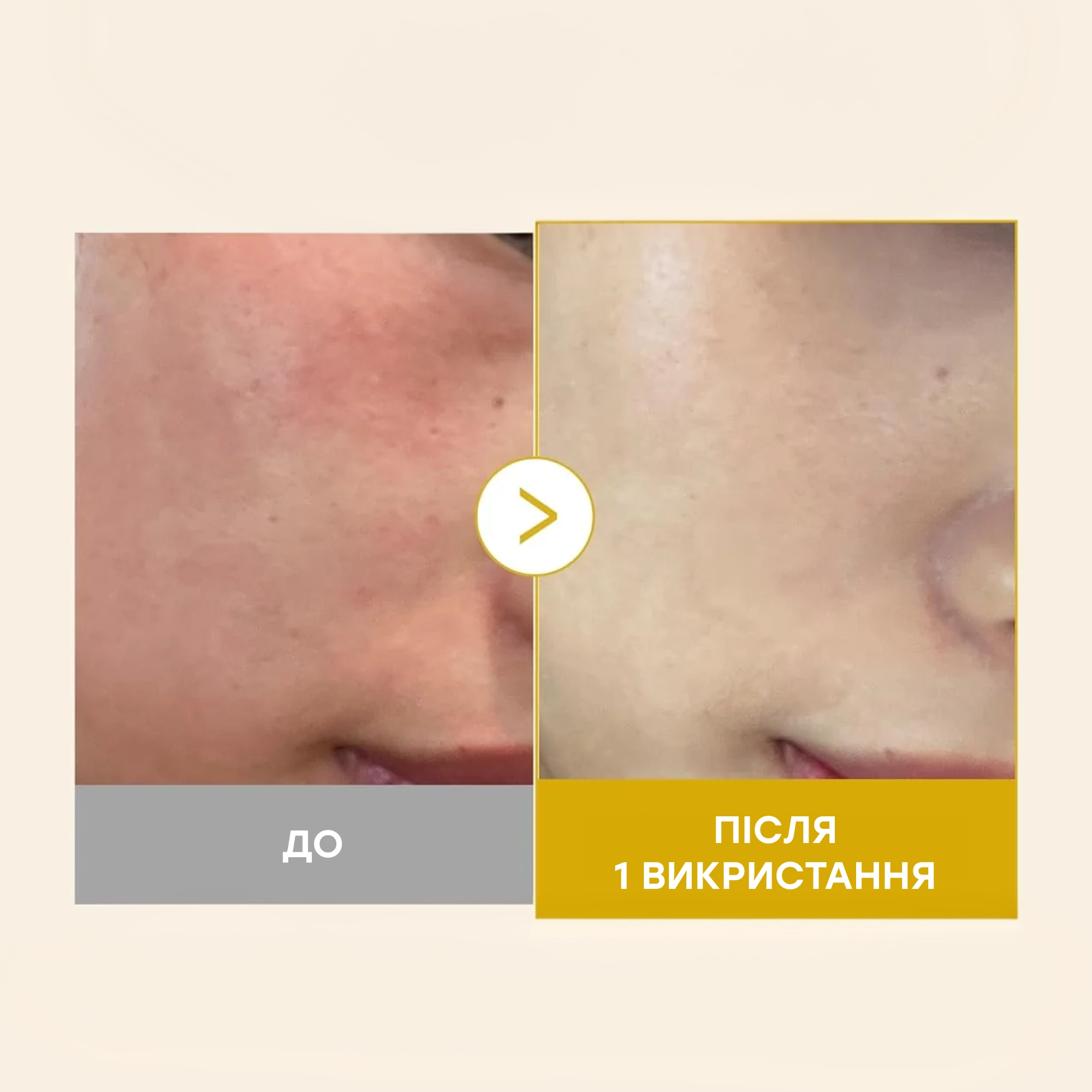 Освітлювальна гель-сироватка з кодзієвою кислотою та куркумою Kojic Acid Turmeric Vita Jelly Mist Serum MEDICUBE Обʼєм 100 мл — фото 5