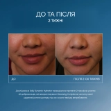 Антивіковий зволожувальний крем з технологією GeneXC Daily Dynamic Hydrator IS CLINICAL Вага 15 г — фото 5