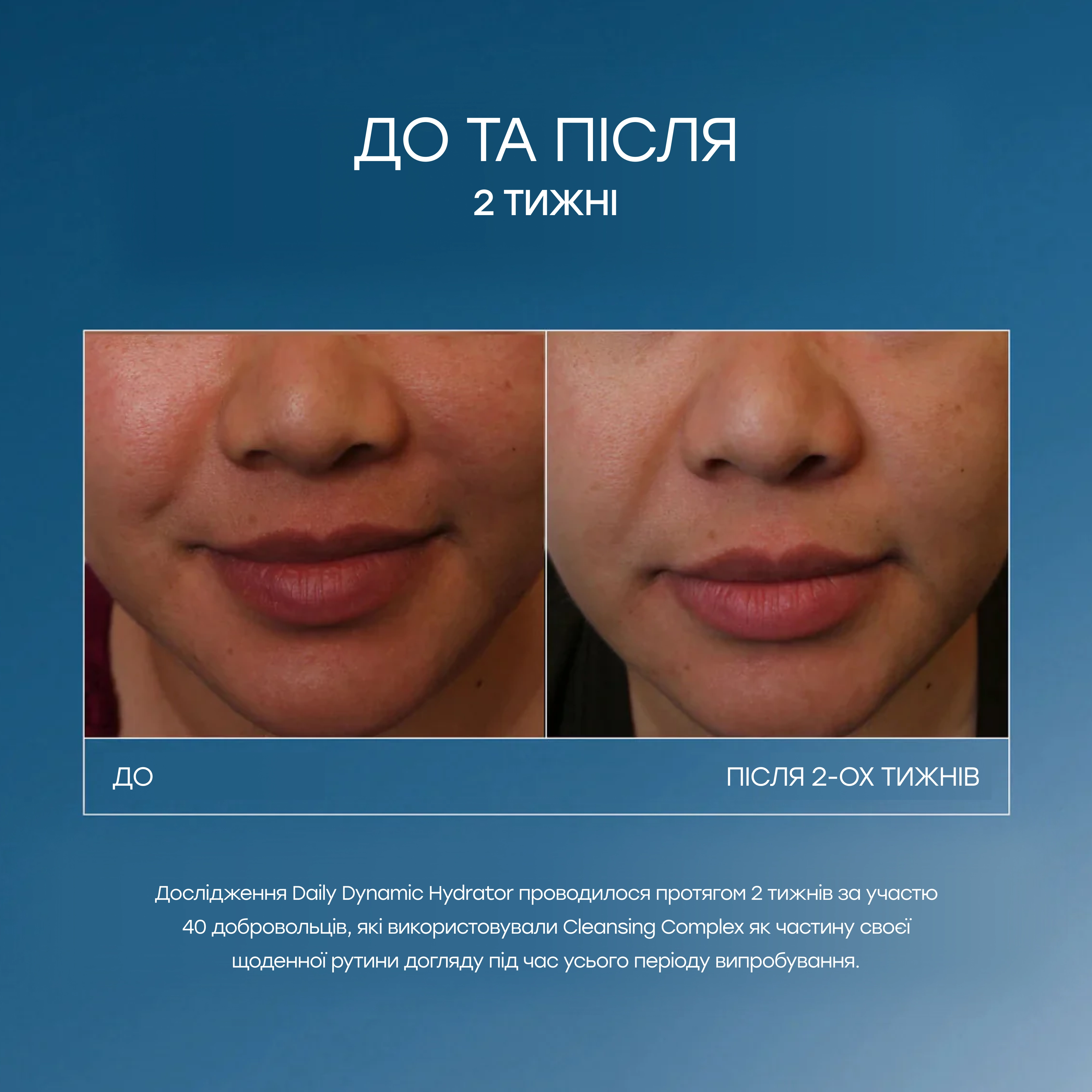 Антивіковий зволожувальний крем з технологією GeneXC Daily Dynamic Hydrator IS CLINICAL Вага 15 г — фото 5