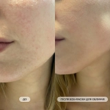 Очищувальна маска для жирної та схильної до висипань шкіри SOS Face Mask MASQMAI Обʼєм 50 мл — фото 5