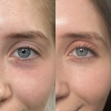 Набір для догляду за шкірою навколо очей Eye Care Set REJURAN — фото 5