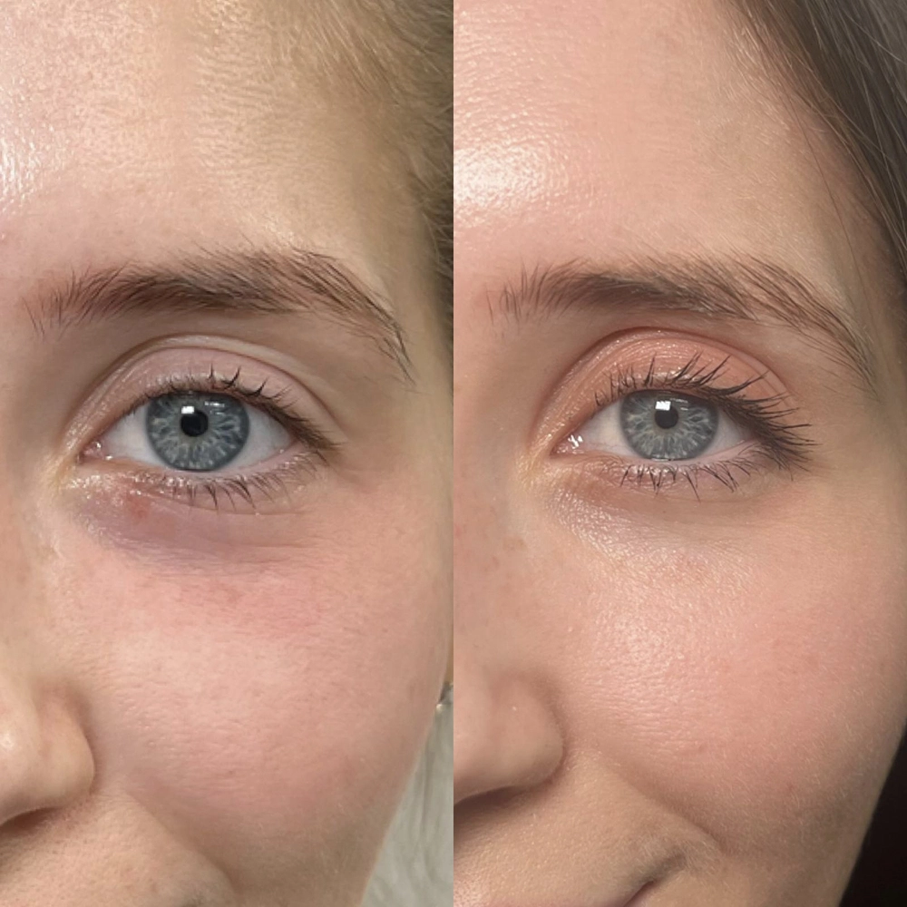 Набір для догляду за шкірою навколо очей Eye Care Set REJURAN — фото 5