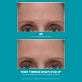 Антивозрастная интенсивная сыворотка для лица Peptide Skinjection Amplified Wrinkle-Fix Serum PETER THOMAS ROTH Объем 30 мл — фото 2