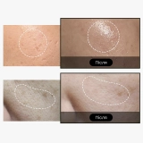 Сыворотка с экзосомами и спикулами для сужения пор 7500 One Day Exosome Shot Pore Ampoule 7500 MEDICUBE Объем 30 мл — фото 4
