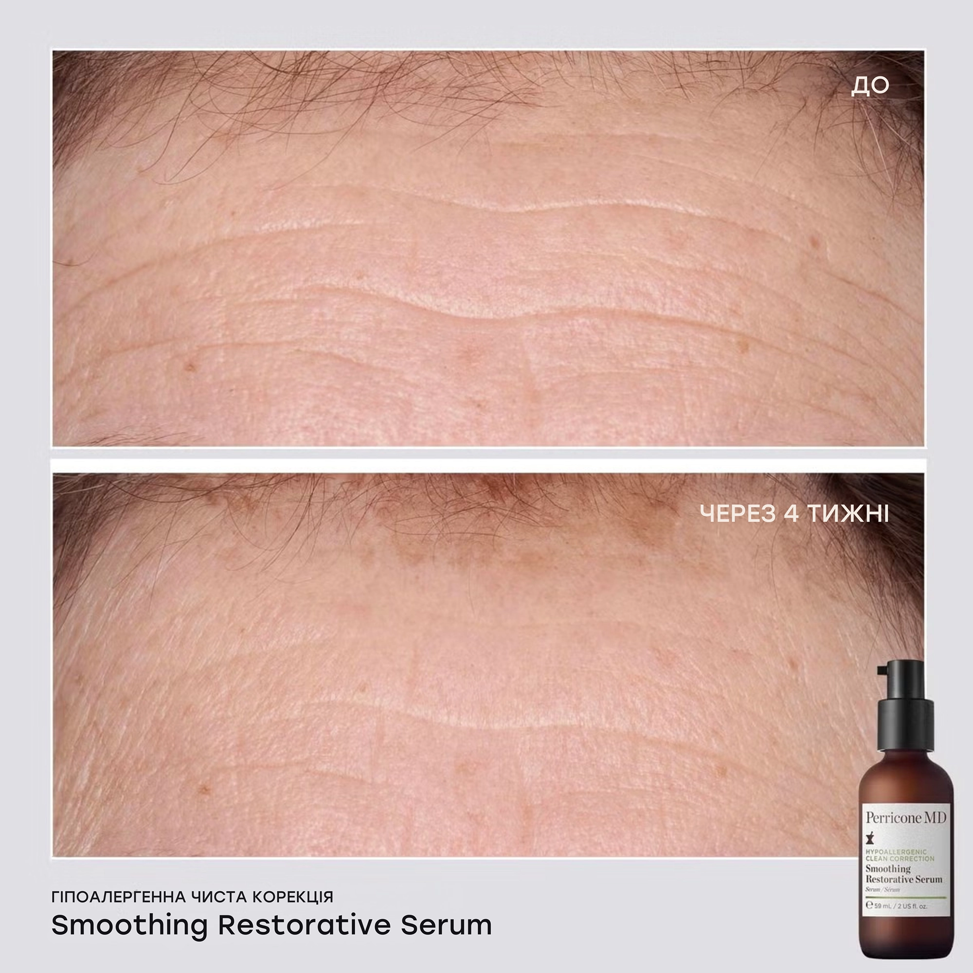 Сверхлегкая сыворотка для чувствительной кожи Hypoallergenic Clean Smoothing Restorative Serum PERRICONE MD Объем 59 мл — фото 4