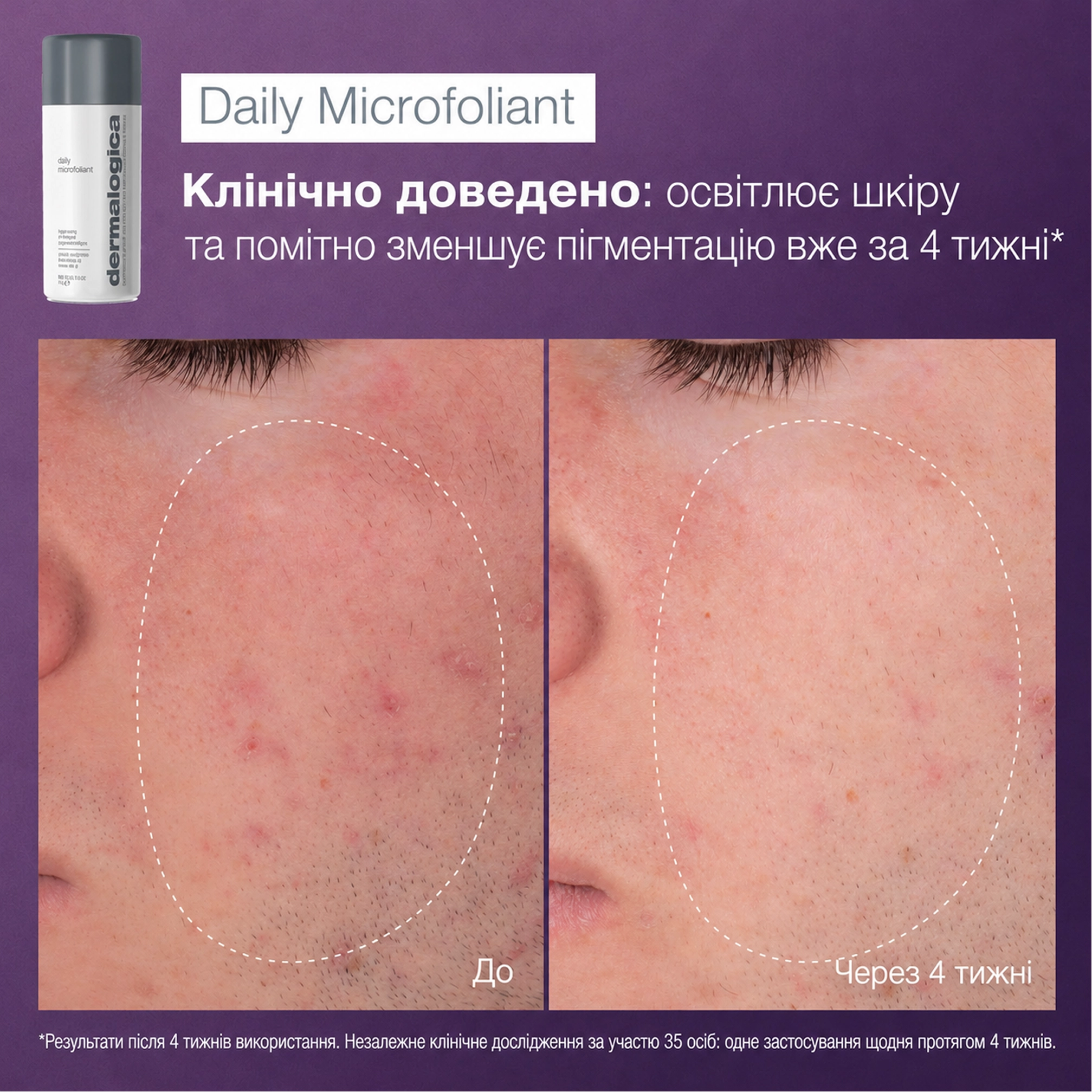 Тревел-набір для подвійного очищення та сяйва шкіри Glow On The Go DERMALOGICA — фото 4