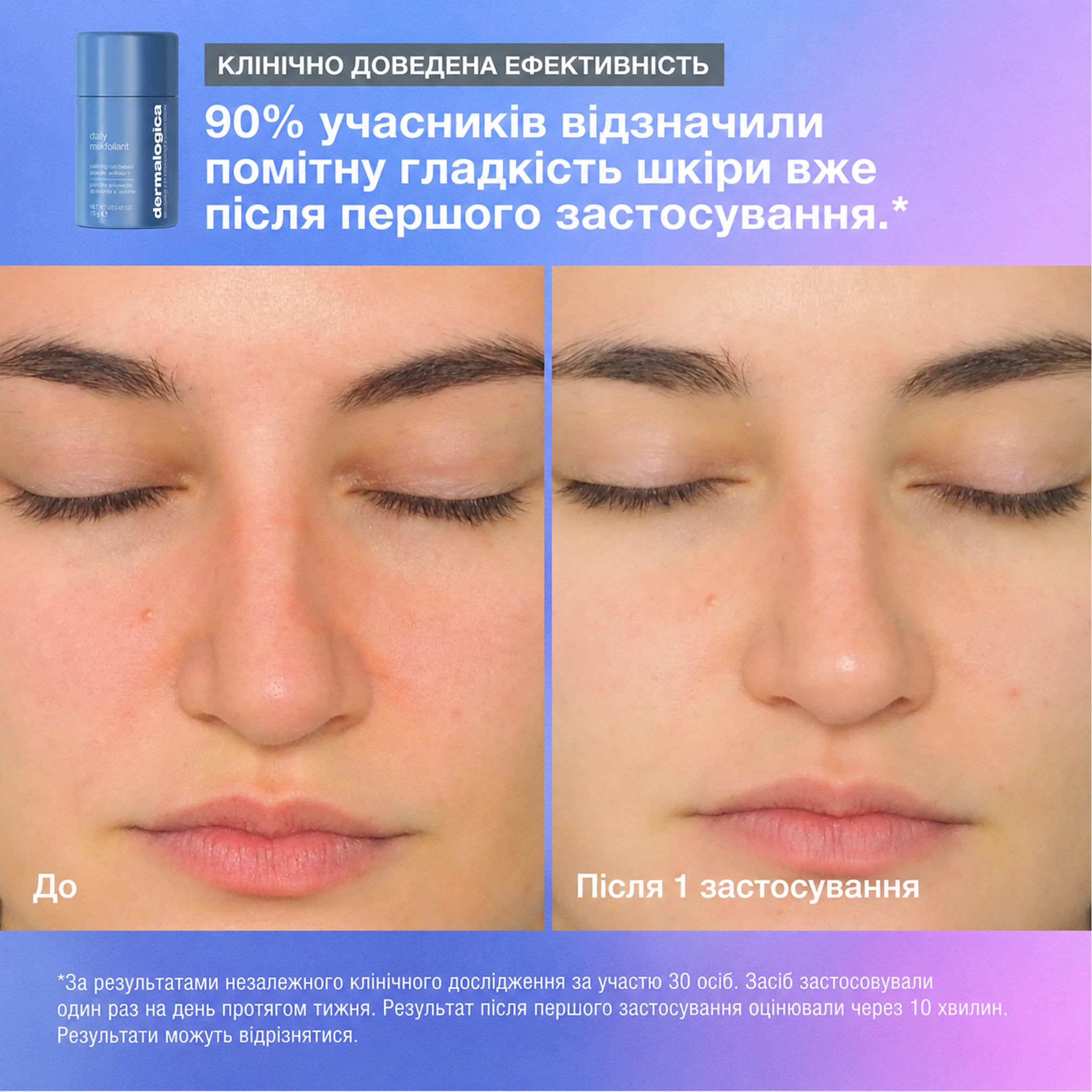 Тревел-набір для відновлення бар’єра чутливої шкіри Expert Barrier Repair DERMALOGICA — фото 4